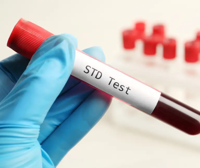 std testing dubai